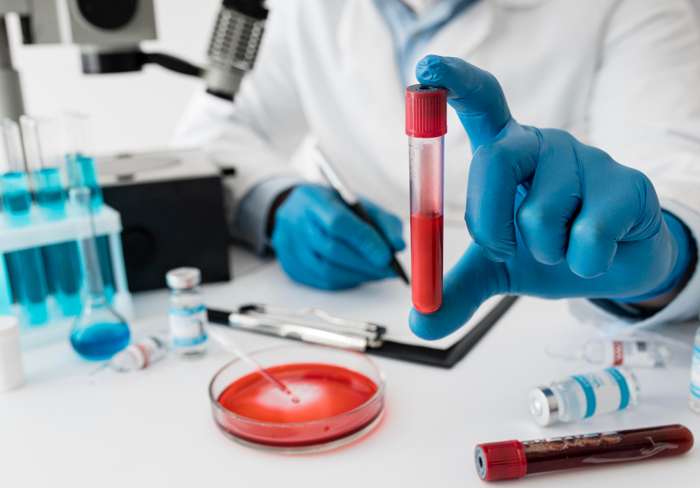 home blood sampling manchester