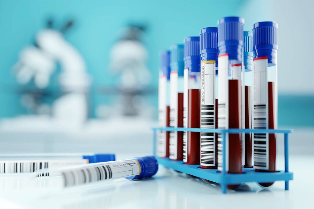 blood testing trends 2026