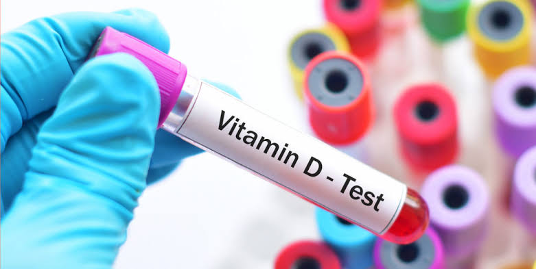 vitamin D blood test